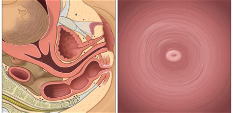 Making sure you're getting proper obstetrical. Cervical dilation - interactive tool | Pregnancy Health ...