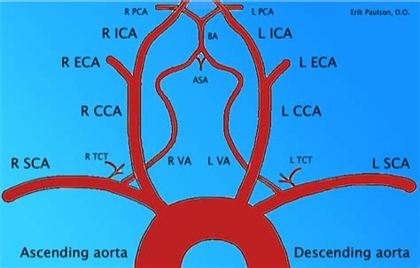 It reaches upwards, as high as the manubrium of the sternum in this tutorial the pathways and branches of aorta are explained in branches we have 4 branches 1 ascending 2 arch 3 thoracic 4. Branches of the aortic arch | Xradiologist
