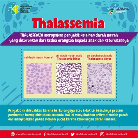Kasein merupakan salah satu protein yang ditemukan dalam susu. Apa itu Thalassemia ? - Direktorat P2PTM