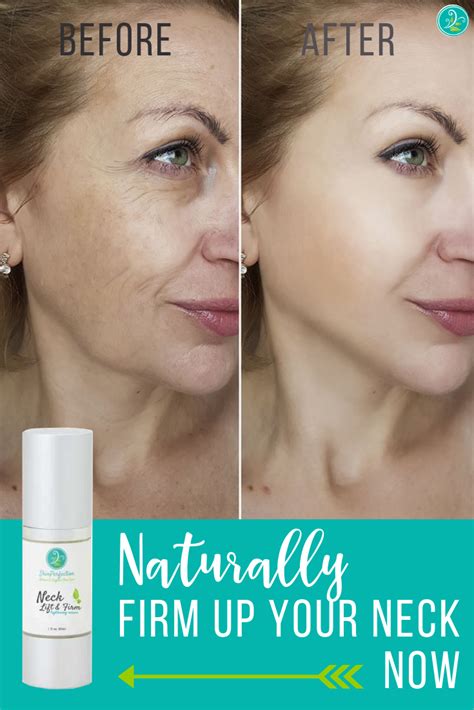 This allows your dermatologist to provide heat exactly where you need it to tighten loose skin. Tighten up those turkey necks naturally with Pepha Tight ...