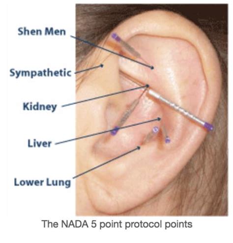 Nada, is a famous hip hop dancer, rapper and singer from south korea. Nada for NADA: "acudetox" not effective in addiction ...