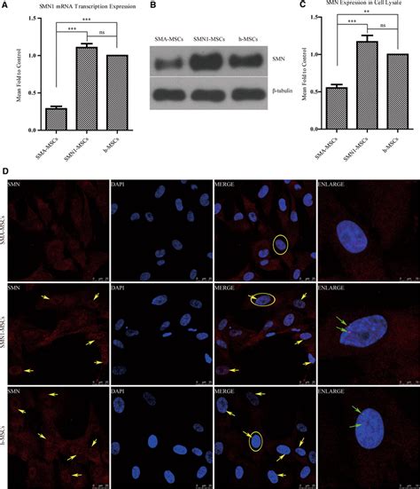 Smn1 is the telomeric copy of the gene encoding the smn protein; SMN1 expression in SMA-MSCs, SMN1-MSCs and h-MSCs. a ...