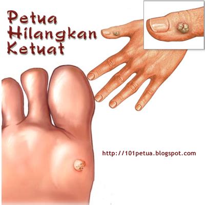 Baca 4 petua & cara menghilangkan batuk dengan berkesan. 101 Petua: Petua Hilangkan Ketuat