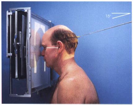 Any radiopacity in this area is suspective of a proces in the anterior mediastinum or upper lobes of the lung. PA AXIAL PROJECTION FACIAL BONES - RadTechOnDuty