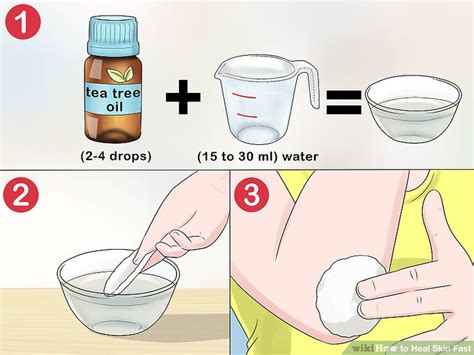 The bleeding associated with scrapes or abrasion is usually minor and easily controlled. 3 Ways to Heal Skin Fast - wikiHow