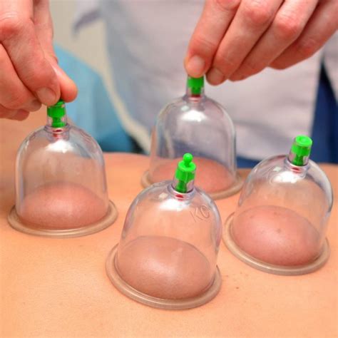 It was a common home remedy for colds, fevers cupping is mostly safe for treating acne. Benefits of cupping - Bahrain This Week