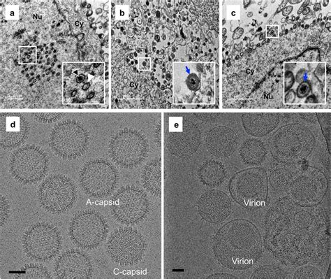 This is dci 2k native, and vlc plays it with no black bars, depending on settings. Electron microscopic imaging of VZV particles a-c ...