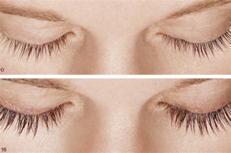 The glue is applied to the line where eyelashes grow, that's why you will remove not only the false lashes, but your own ones as well. Latisse® in Summit, NJ | Daniels Group
