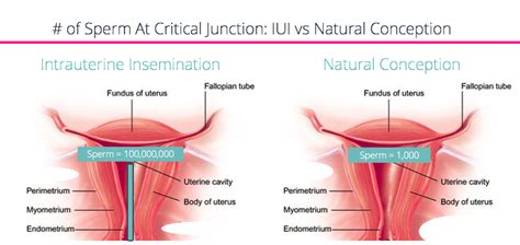 Process in operating system marathi. FertilityIQ: An Overview of IUI