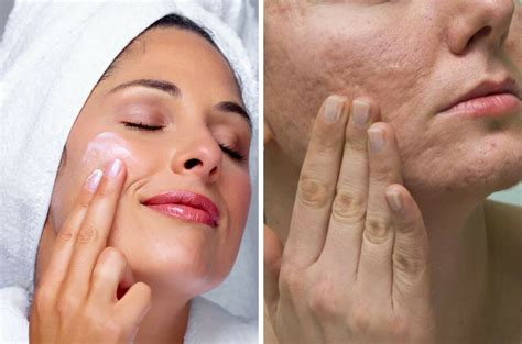 Merkuri yang terkandung dalam produk kosmetik boleh menyebabkan kerosakan pada buah pinggang dan sistem saraf. Nak Cantik Boleh Tapi Jangan Guna 8 Produk Kosmetik ...