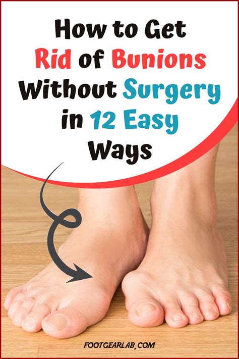 Maybe you would like to learn more about one of these? How To Get Rid Of Bunions Without Surgery In 12 Easy Ways ...