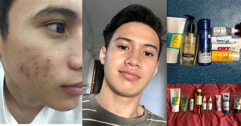 Memiliki kandungan ceramides, produknya mampu memperbaiki kulit kusam. Segan Nak Selfie Sebab Muka 'Ketiak', Lelaki Ini Dedah ...