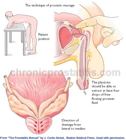 Deep prostate examination ends in fisting. Ramayya Pramila Urology Hospital: All you want to know ...