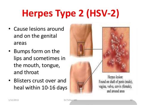The reason for this is that. SYMPTOMS OF GENITAL HERPES - MeetPositives.com