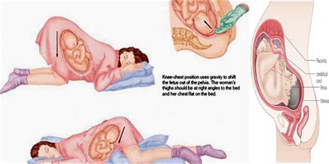 This position allows him to keep most of his weight off your belly. ARE YOU PREGNANT OR SOMEONE YOU KNOW? Here are Proper ...