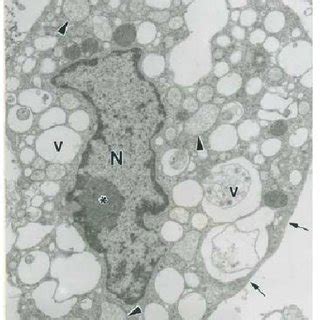 The 'vero' lineage was isolated from kidney epithelial cells extracted from an african green monkey (chlorocebus sp.; VERO cell in initial apoptosis with many electron transparent vacuoles... | Download Scientific ...