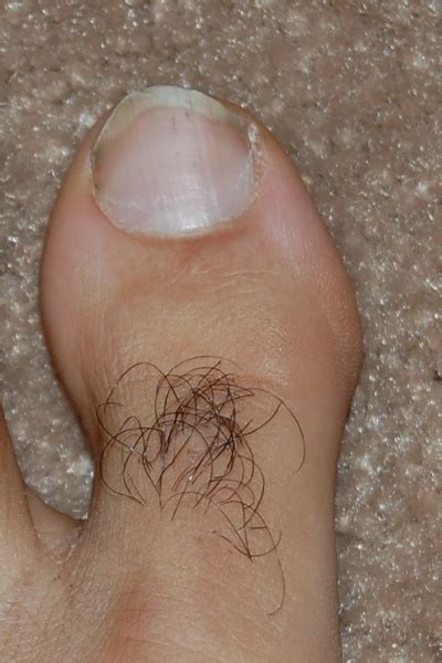 Hair removal—and whether or not to remove hair at all—is a very personal choice. 80 best UGLY FEET images on Pinterest | Weird, Health and ...