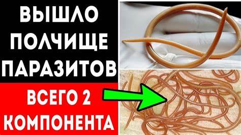 Диета для очистка кишечника ЧИСТКА КИШЕЧНИКА от "ГРЯЗИ" и ПАРАЗИТОВ! Моментальное выведение из ЧИСТКА КИШЕЧНИКА от "ГРЯЗИ" и ПАРАЗИТОВ! Моментальное выведение из Диета для очистка кишечника