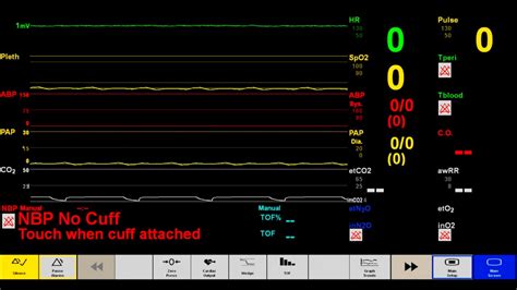 Patient monitors are precise, provide a fast measurement of vital signs. Vital Signs Monitor - YouTube