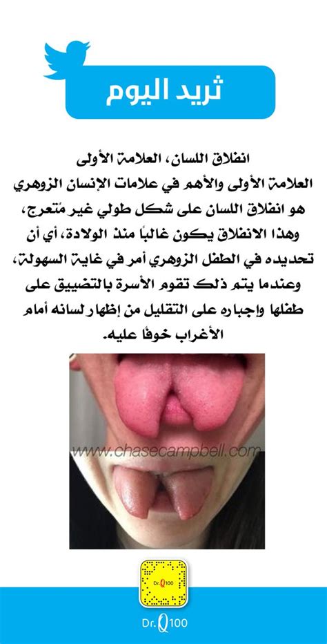 1,276 likes · 15 talking about this. علامات لسان الانسان الزهري