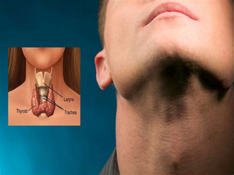 Blood clots are formed in the body when the platelets and various other proteins help blood to form into a semisolid mass. High Thyroid Hormone Can Be Risky For Your Heart Says ...