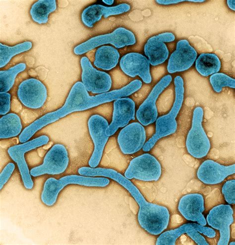 The world health organization (who) rates it as a risk group 4 pathogen (requirin. Marburg Virus Particles | Colorized transmission electron ...