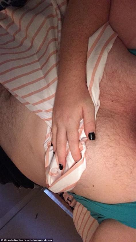 That goes for men and women. Virginia woman with excessive body hair celebrates her ...