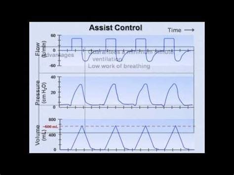 What is the lingo used with ventilators, and what do those settings mean. Pin by Serena Norris on CCRN/Nursing knowledge | Nursing ...