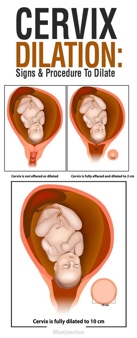 At about 6 to 8 centimeters in dilation, you may smell a heavy, dusky scent. Cervix Dilation: Signs, And Procedure To Dilate | Cervix ...