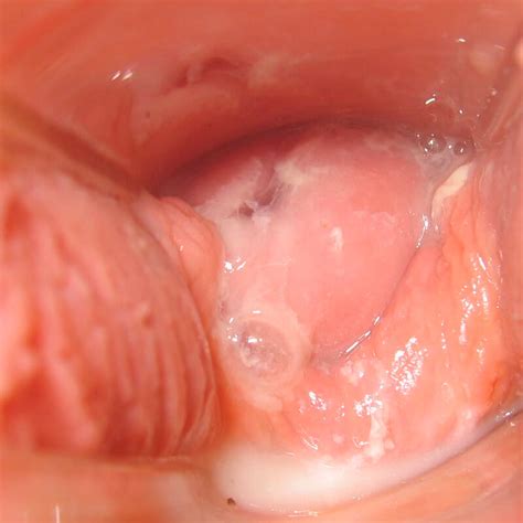 Creamy mucus is a more favorable sign regarding egg embedment. White Cervical Mucus 4 Weeks Pregnant | carfare.me 2019-2020