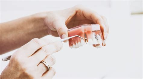 Halo ibu karmilah di jakarta, untuk menentukan apakah gigi geraham anda harus dicabut atau masih dapat dipertahankan, perlu dilakukan pemeriksaan langsung oleh dokter gigi, serta pemeriksaan penunjang. Menelisik Fakta Pencabutan Gigi Bagian Atas - RS Al-Irsyad ...