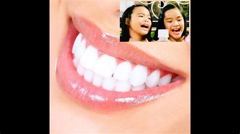 How often should you whiten teeth at home? How to whiten your teeth in just two weeks? - YouTube