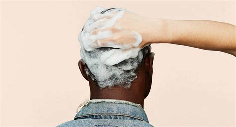 These symptoms developed six days after the use of a hair dye containing ppd. How to Grow Hair on a Bald Spot | hims