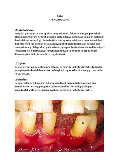 Adalah penyakit autoimun yang dikenal sebagai diabetes remaja. Diabetes Mellitus Dan Penyakit Periodontal