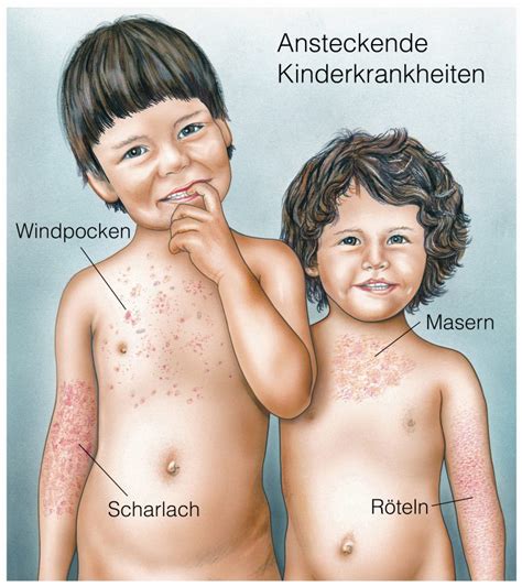 Der arzt kann darüber hinaus in. Achillessehnenverletzung (Achillessehnenriss) --> Behandlung