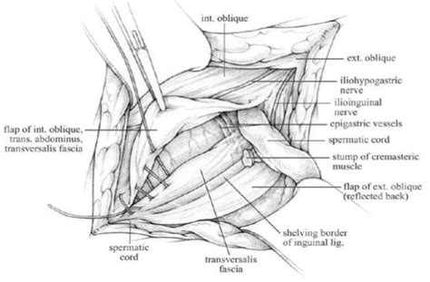 The purpose of this chapter is to describe the anatomic landmarks of the groin region. Surgical Anatomy of the Groin | IntechOpen