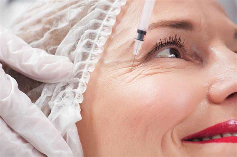 Check spelling or type a new query. How Long Does it Take for Botox to Work? 6 FAQs - Health Blog