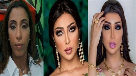 قبل وبعد للمغنية دنيا بطمة. شاهد : صور صادمة لمراحل تطور جمال دنيا بطمة قبل وبعد ...