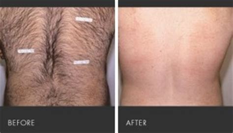 Imagine having smooth, hairless skin all over your body without having to shave or wax ever again! Revitol Body Hair Removal Lotion Reviews & Apparent Scams