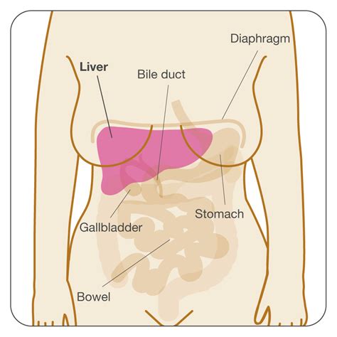 The initial stages are asymptomatic and the symptoms develop in the advanced stages. Secondary breast cancer in the liver