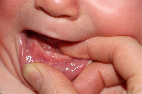 Sebagian bayi akan sering menangis, rewel, atau mulai banyak menggigit. Jika Usia 8 Bulan Bayi Belum Tumbuh Gigi, Berikan Anak ...