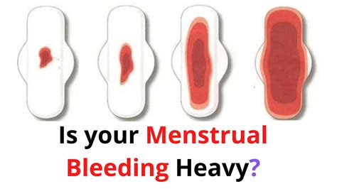 How do you stop bleeding so much on your period? Is your Menstrual Bleeding Heavy - Reasons & How to stop it.