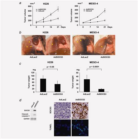 Check spelling or type a new query. Overexpression of SOCS3 exhibits preclinical antitumor ...