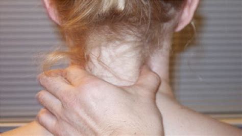 It does not protrude out of the skin and can't be seen. how to get rid of knots in your neck by yourself - YouTube
