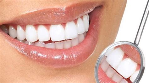 Gigi palsu adalah perawatan untuk menggantikan gigi yang hilang. Mengetahui Jenis Serta Harga Gigi Palsu Terbaru Dan ...