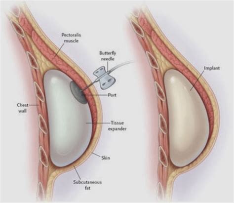 55 its so big its stretching my insides. Becky's Big Bytes: Anjelina Jolie didn't wake up with new ...