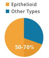 Maybe you would like to learn more about one of these? Epithelioid Mesothelioma: Epithelial Cell Prognosis ...