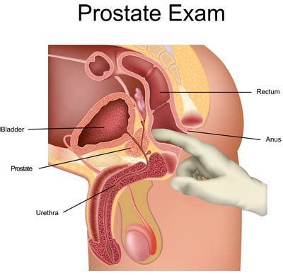 2020 is a great year for the virgos. Digital rectal examination for prostate cancer by GPs ...