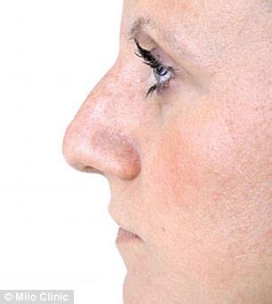 Where can you get your nose pierced at 13 near me ile ilgili kitap bulunamadı. The NO-KNIFE nose job: the revolutionary procedure that ...