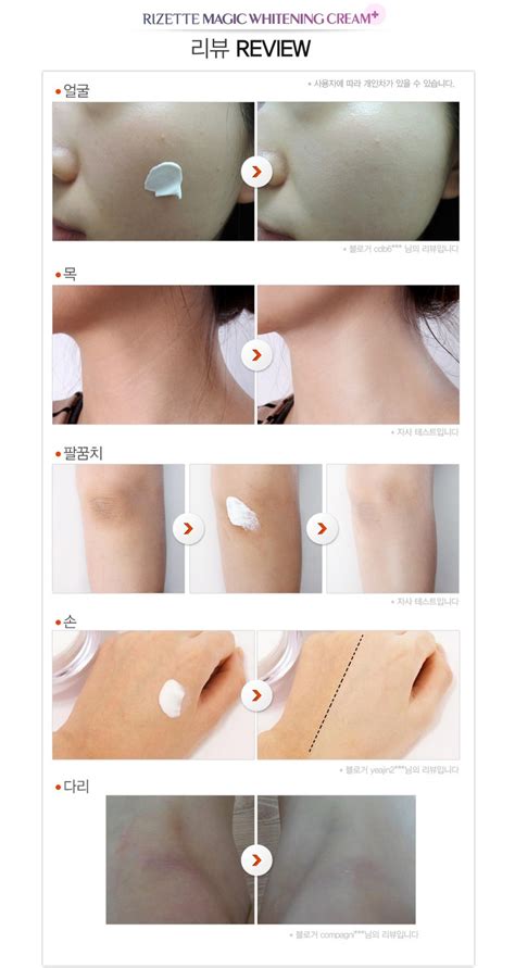 Dry skin, combination skin, normal skin, oily skin. Rizette: Rizette Magic Whitening Cream plus OFFER RM189.00 ...